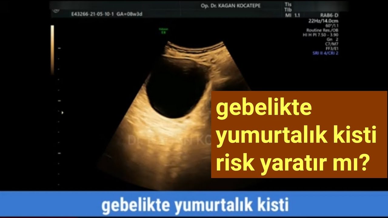 kıyafetteki tükenmez kalem izi nasıl çıkar balkona kuşların gelmemesi için ne yapılır