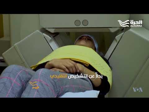 ما الذي يجري بداخل جمجمة كل من ا