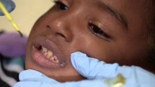 Provider Training   Fluoride Varnish HD screenshot 1