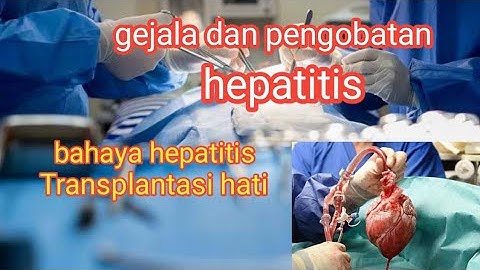 gejala dan cara pengobatan hepatitis