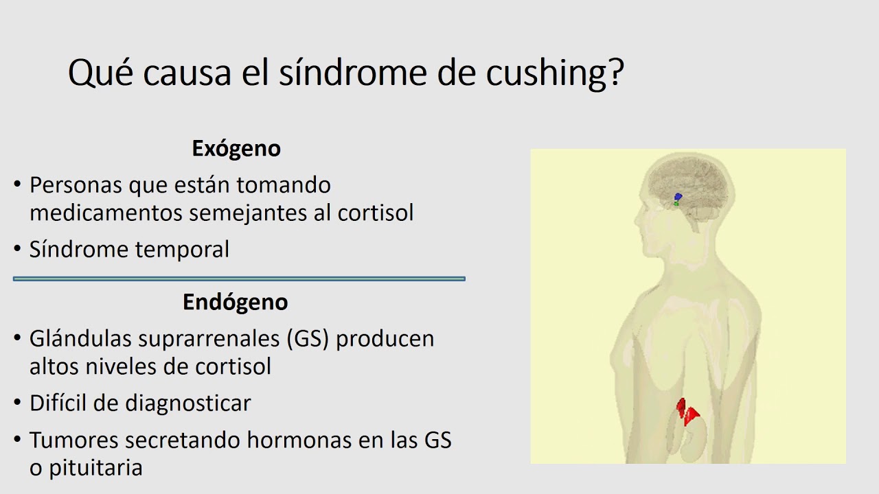 Sindrome de Cushing YouTube Sindrome de Cushing YouTube