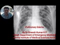 Pulmonary edema by Dr Gireesh Kumar KP