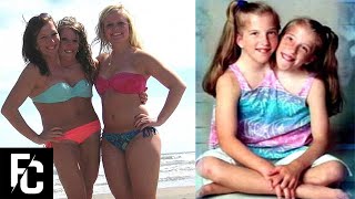 6 Longest Living Conjoined Twins You Wont Believe Exist | LIST KING