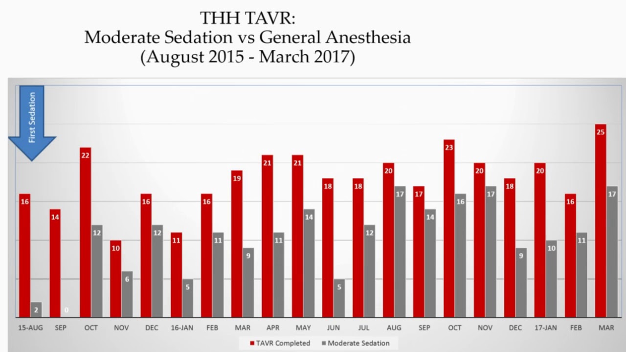 The True Meaning of the Minimalist Approach - David L. Brown, MD interventional cardiology jobs