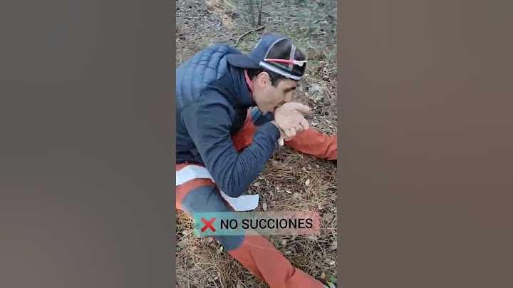 SNAKE BITE 🐍how to act. #shorts #survival #tutorial