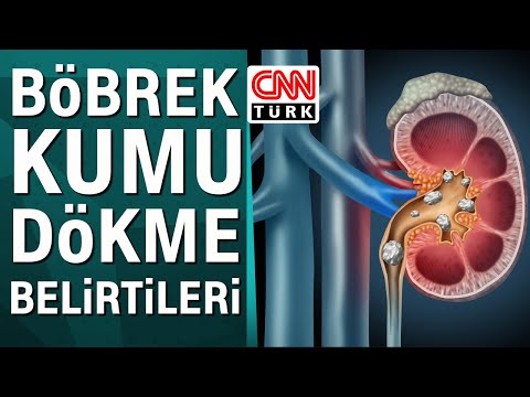 Video: Kırmızı kumtaşı nereden geliyor?