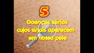 Ou cutânea navalha std queimar erupção