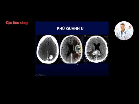 CT U NÃO | PGS. TS. Lê Văn Phước