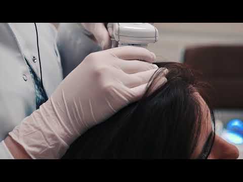 თმის ცვენის დიაგნოსტიკა | Hairline International / ჰეალაინი