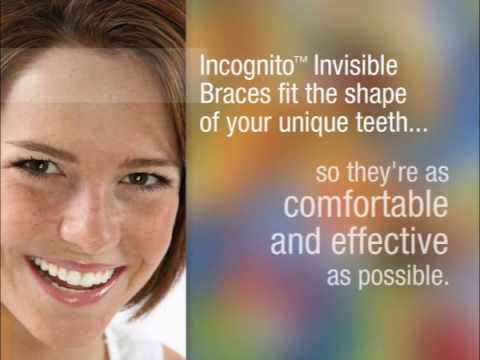 3M Incognito - Invisible braces used by Dr. Cope