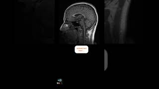 Mri Scanner Error Or User Error?