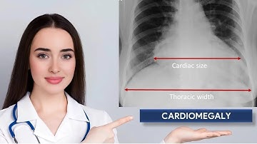 Cardiothoracic Ratio & Cardiomegaly in Chest X-ray