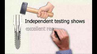 Bio | Max Mini Implants Video Bio | Max Mini Implants Video