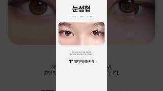자연스러운 눈성형 잘 하는 곳을 찾는다면?