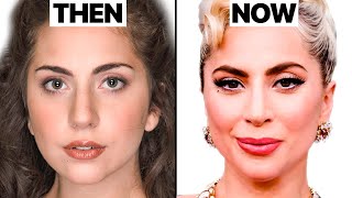 Lady Gaga NEW FACE | Plastic Surgery Analysis