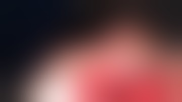 Stratafix Knotless Tissue - Full Arch Wound Closure with Dr. Raman Kohli