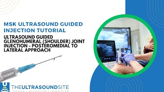 Ultrasound guided glenohumeral (shoulder) joint injection - posteromedial to lateral approach