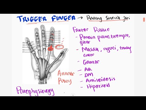 Patofisiologi Trigger Finger : Nyeri di Sendi Jari Karena Inflamasi