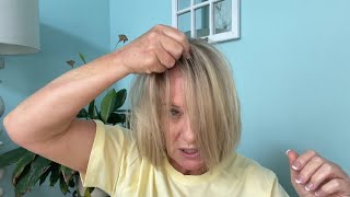 Frontal Fibrosing Alopecia | Time for a wig?
#frontalfibrosingalopecia
#wig
#FFA
Two years ago, I was diagnosed with FFA .  I was not ready to accept it mentally because I was also dealing with skin cancer. I was not denying I had FFA, but I did not think it was necessary to stress about it or use steroids for treating it.
I’m beginning to realize a wig is my best option, but I have no idea where to start.
I’m documenting this journey and I’m hopeful my yt community will provide support and advice.
Here is a link to my video the day I was diagnosed with FFA:
https://youtu.be/BYTdUcHwRto?si=DwUj8qoReX2iOy91 Frontal Fibrosing Alopecia | Time for a wig?