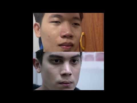 ล้อเลียนตัวอย่างหนัง ฟรีแลนซ์..ห้ามป่วย ห้ามพัก ห้ามรักหมอ (Official Trailer)