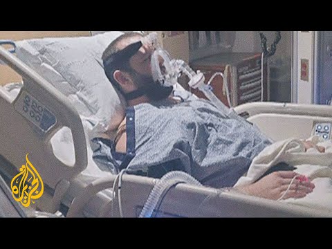 مستشفى أمريكي يرفض إجراء عملية زرع قلب لمريض رفض تلقي لقاح كورونا