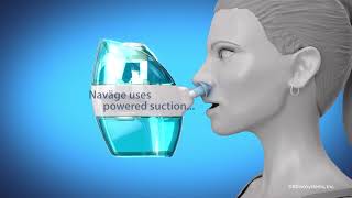 Naväge Nasal Care Animated Video