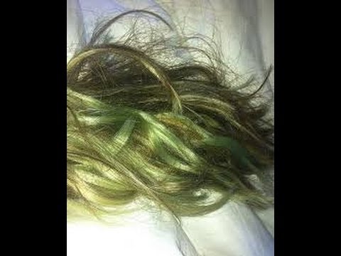 What Causes Green Hair Dermtv Com 539 Youtube