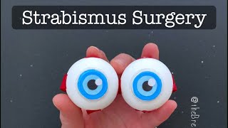 Playdough Surgery 🔪👀 - Strabismus Surgery