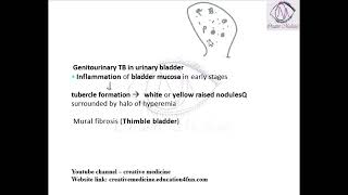 Lec 6 Genitourinary Tuberculosis   in Bladder