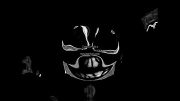 Klasky Csupo Center Effects in Darth Vader Major