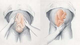 General Physical Extion For Obstetrics Pregnant Women