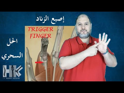 Trigger Finger, The Magic Solution ومضات طبية: إصبع الزناد.. والحل السحري