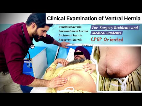 Clinical Examination of Ventral Hernia - Dr Tayyab Riaz Ch