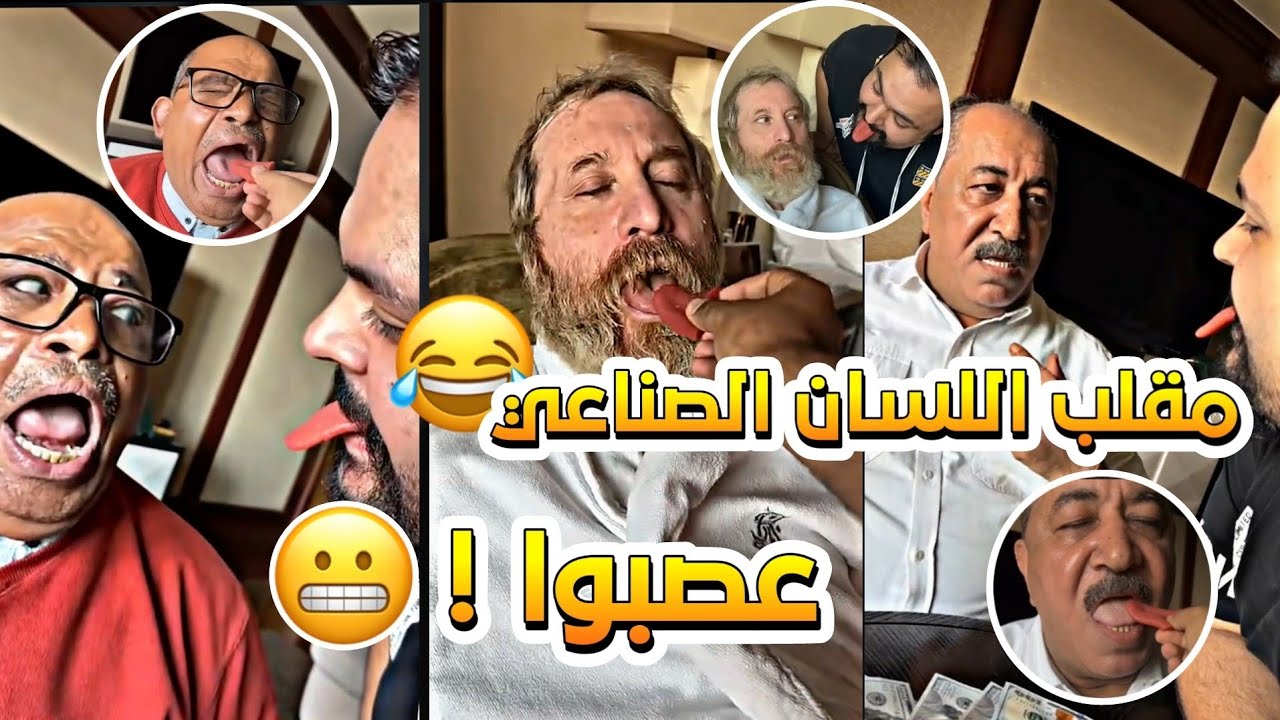 حطيت لسان صناعي والشمالي مقلبهم 🤣😂 |