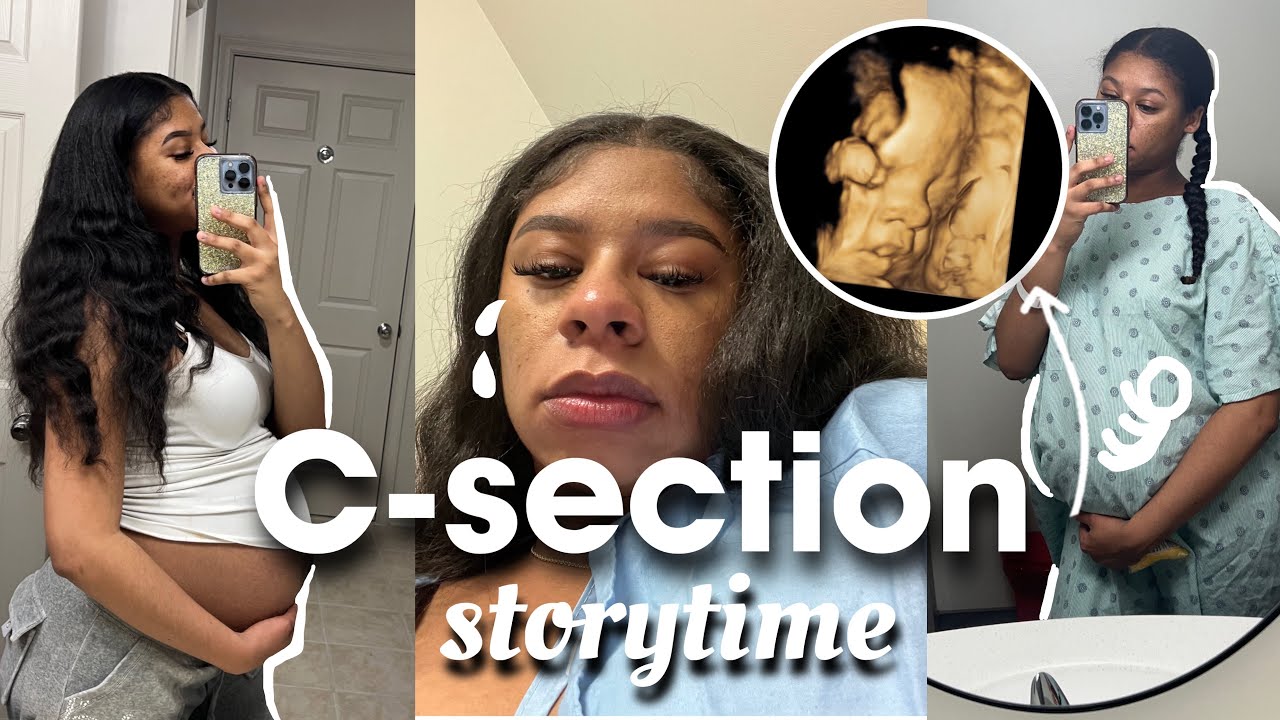 My C-Section Experience (Part 1) | Why I Had To Get One 😅 - YouTube