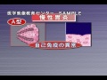 病気の基礎知識 病気の成因・病態の治療　Vol.4 消化の領域