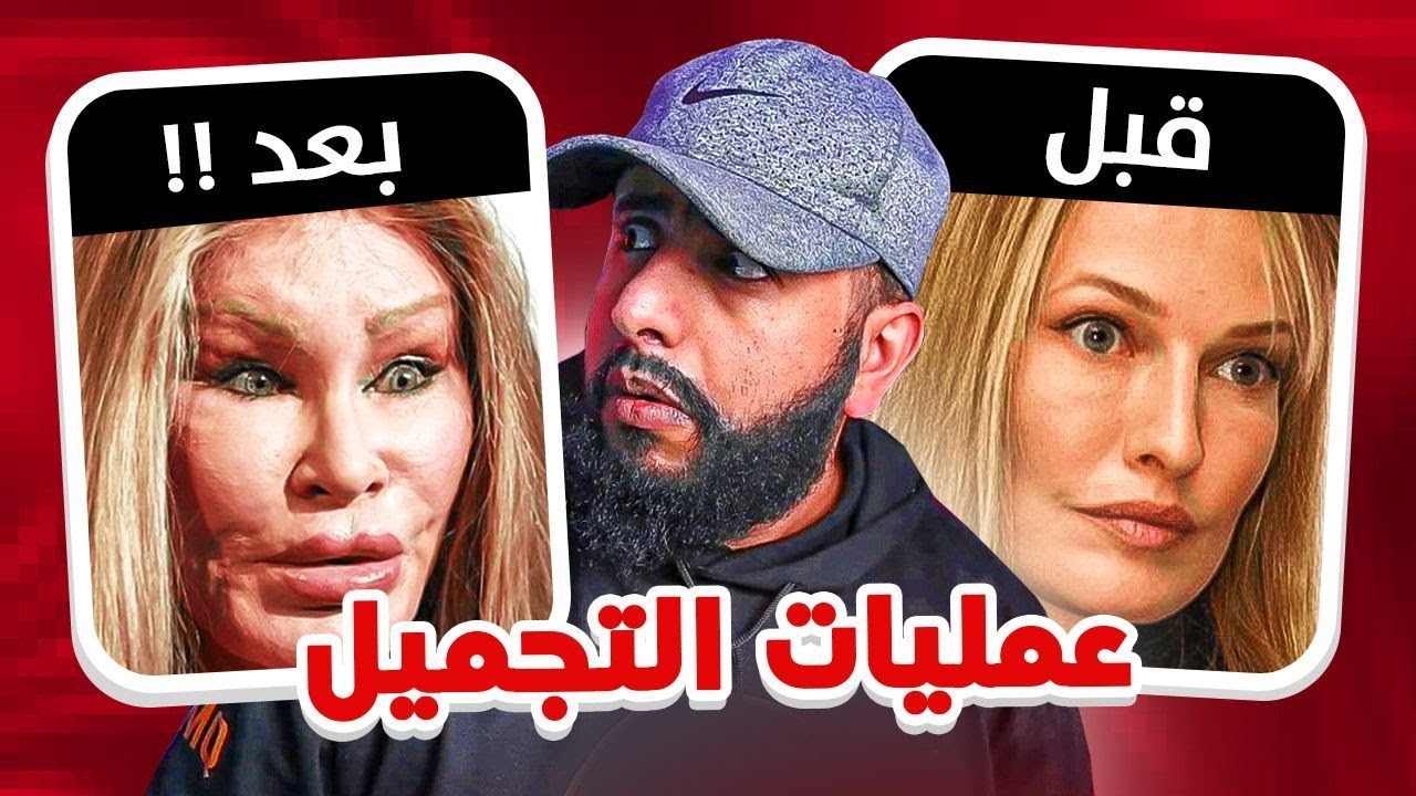 مشاهير قبل و بعد عمليات التجميل   رح تنصدم و اتحداك ما تضحك