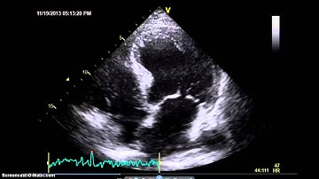 AccreditCoach:  Image Quality   On axis