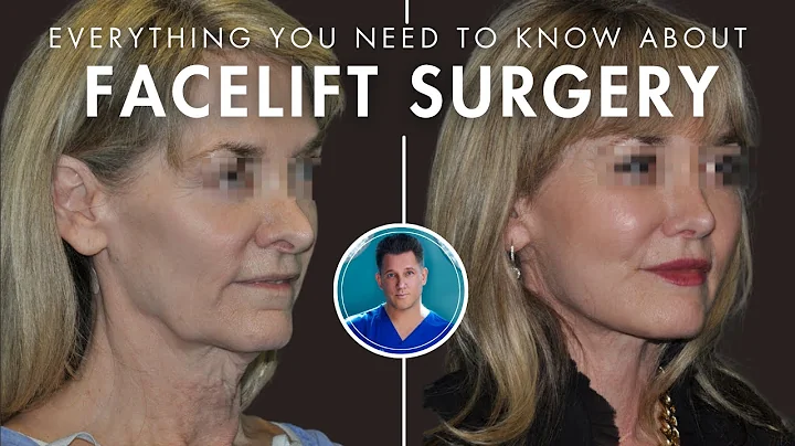 Facelift 101: before and after recovery, Deep Plane Facelift + Stem Cell Facelifts, and more!