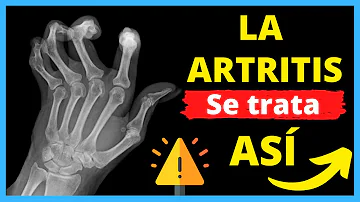 ¿Cuál es el mejor medicamento para la artritis inflamatoria?