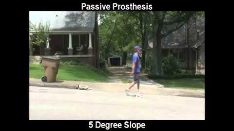 Vanderbilt powered leg prosthesis