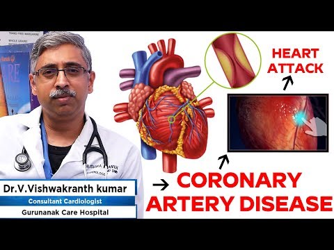 How to diagnose coronary heart diseases | Cardiologist Dr. V. Vishwakranth Kumar Care Hospitals