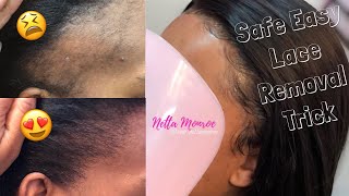 EASIEST WAY TO REMOVE GLUED LACE AND NOT LOSE YOUR EDGES | IAM_NETTAMONROE