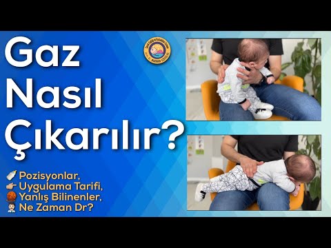 Video: Tifo Aşılarını Atmanın Basit Yolları: 8 Adım