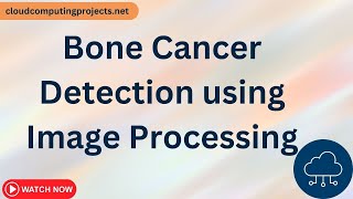 Bone Cancer Detection using Image Processing