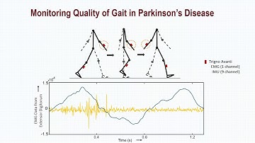Webinar – Autonomous Gait Monitoring in Parkinson’s Disease