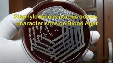 Staphylococcus aureus colony characteristics on Blood Agar