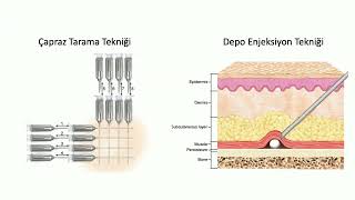 Ultrasound Asisted Cadaver Course Part 5