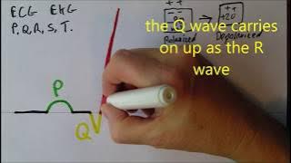 Heart 8, ECG waves