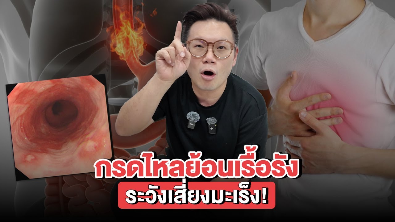 กรดไหลย้อนเรื้อรัง ระวังเสี่ยงมะเร็ง !!! #หมอเจด #หมอเจดสุขภาพ #กรดไหลย้อน #สุขภาพดี #ความรู้